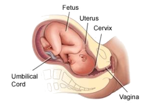 Caesar Babies and Autoimmune Diseases The Birth Canal