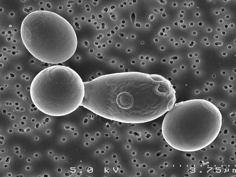 Saccharomyces boulardii a live probiotics