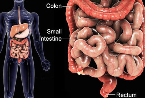 IBS - Irritable Bowel Syndrome - Visual guide to IBS