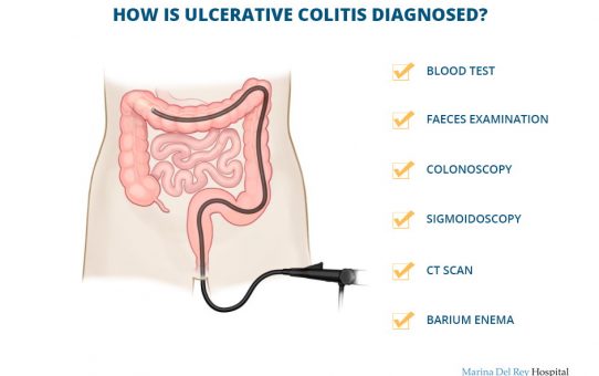 Ulcerative colitis - Diagnosis
