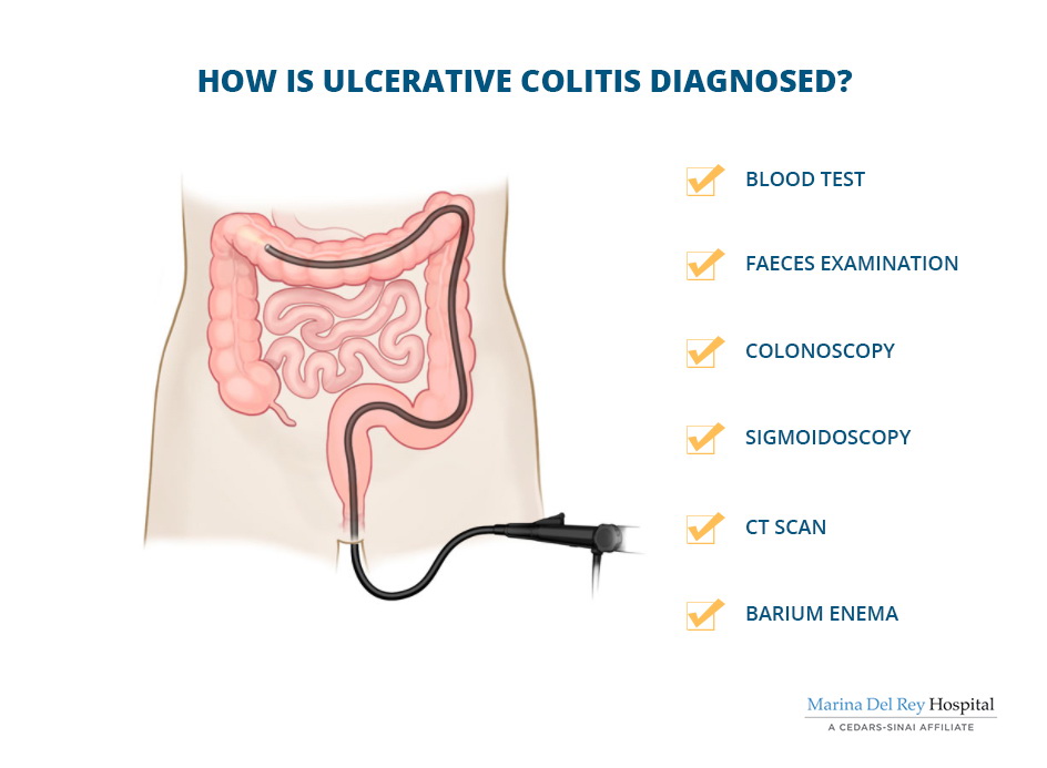 What Is Ulcerative Colitis Symptoms Causes Diagnosis And Treatment My